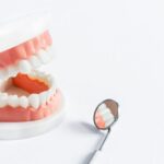 Understanding Tooth Decay Progression
