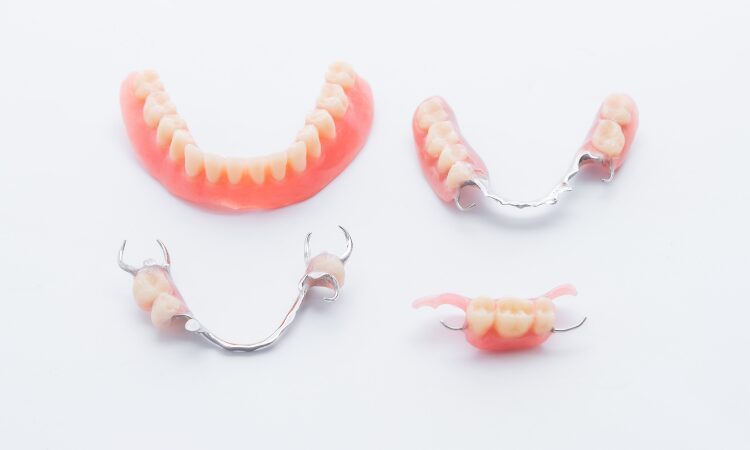 With careful attention and proper maintenance, you can keep your partial denture in excellent condition for years.